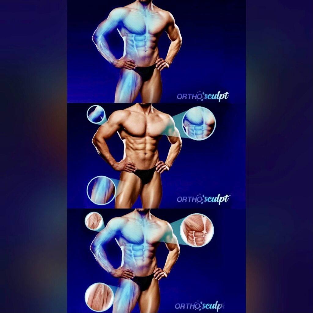 OrthoSculpt 3D Body Model - Dr Cyr