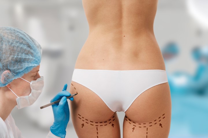 How much Does BBL (Brazilian butt-lift) surgery cost?