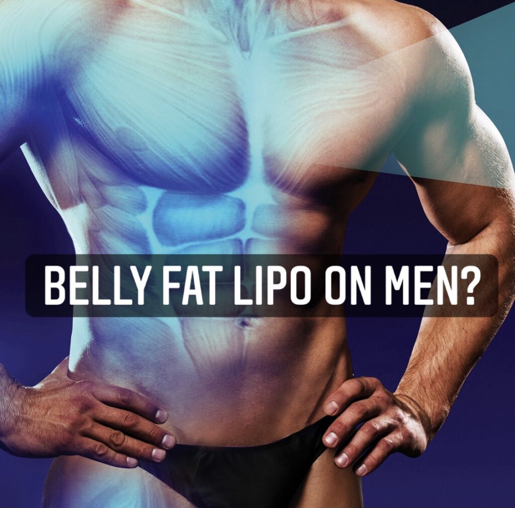 Belly Fat Lipo on Men