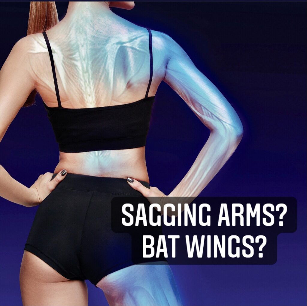 Sagging Arms